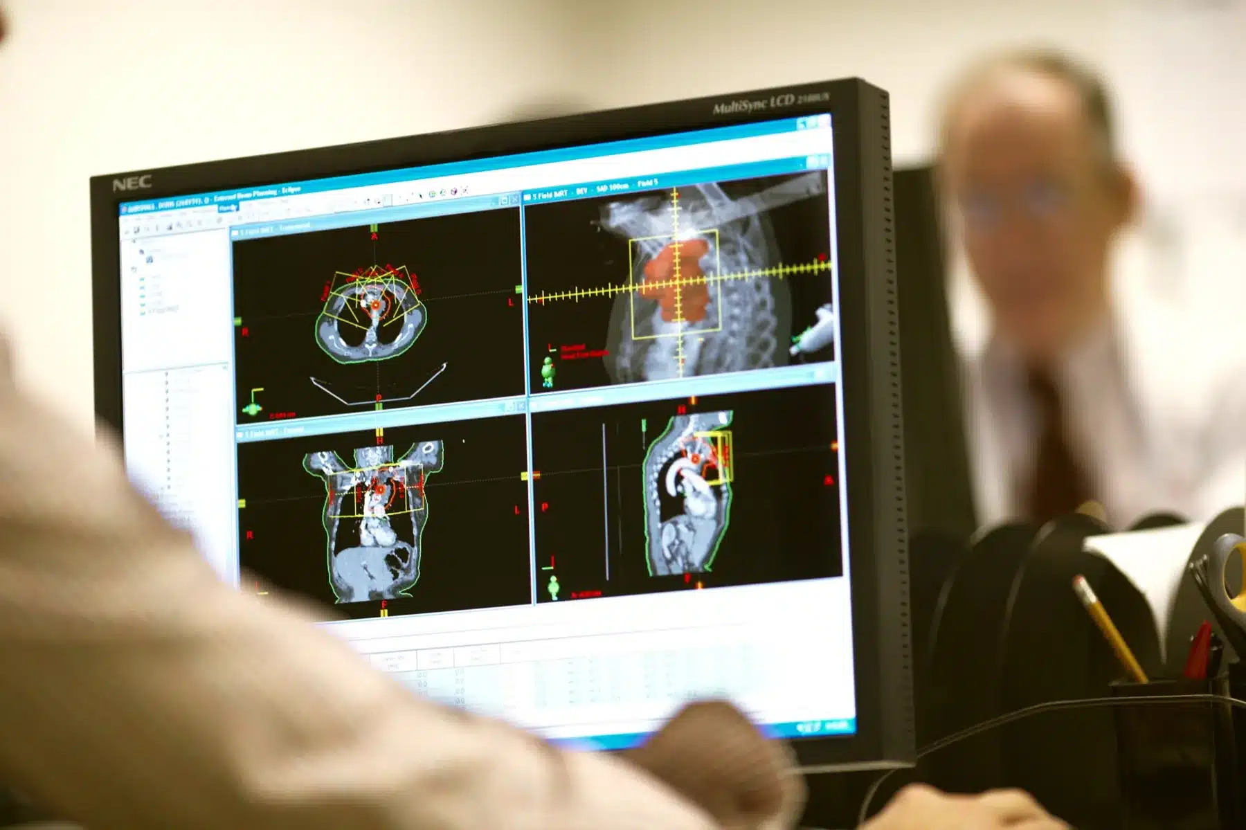 Care team reviewing treatment imaging on screen